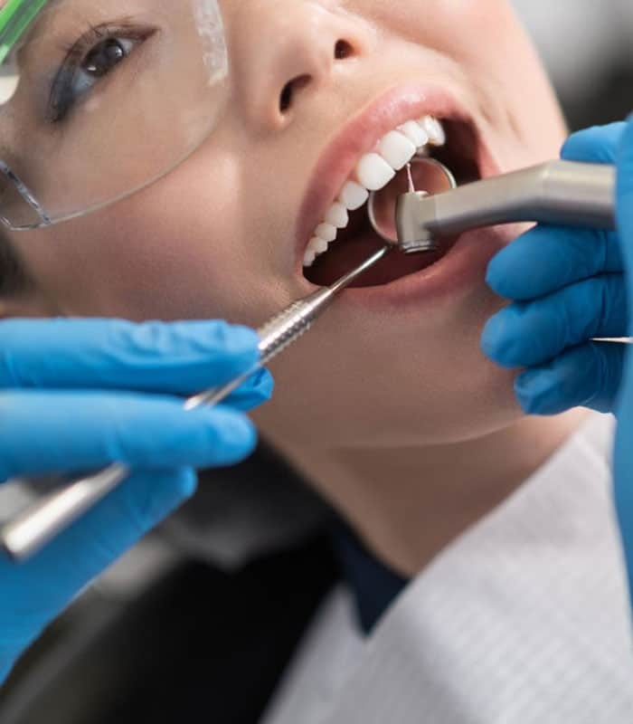 Tooth Extraction Tampa Palms
